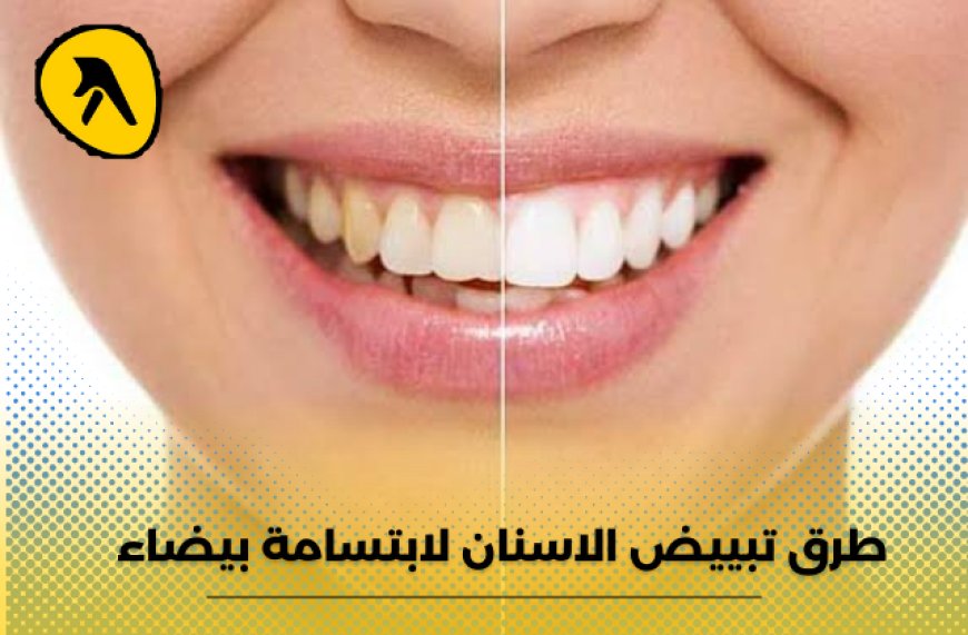 طرق تبييض الاسنان لابتسامة بيضاء.. إليك أفضل العيادات في الكويت